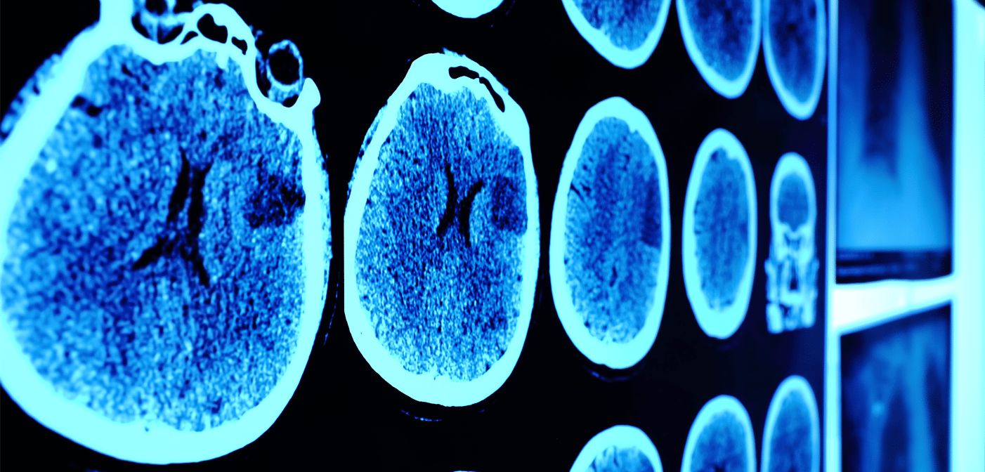 0117 Hn 9 Brain Aging Sins That Kill Your Competitive Edge 1402x672